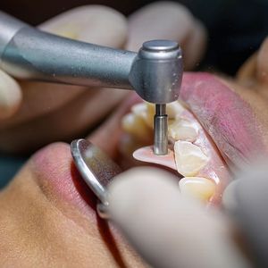 True White Dental Shaping  Polishing