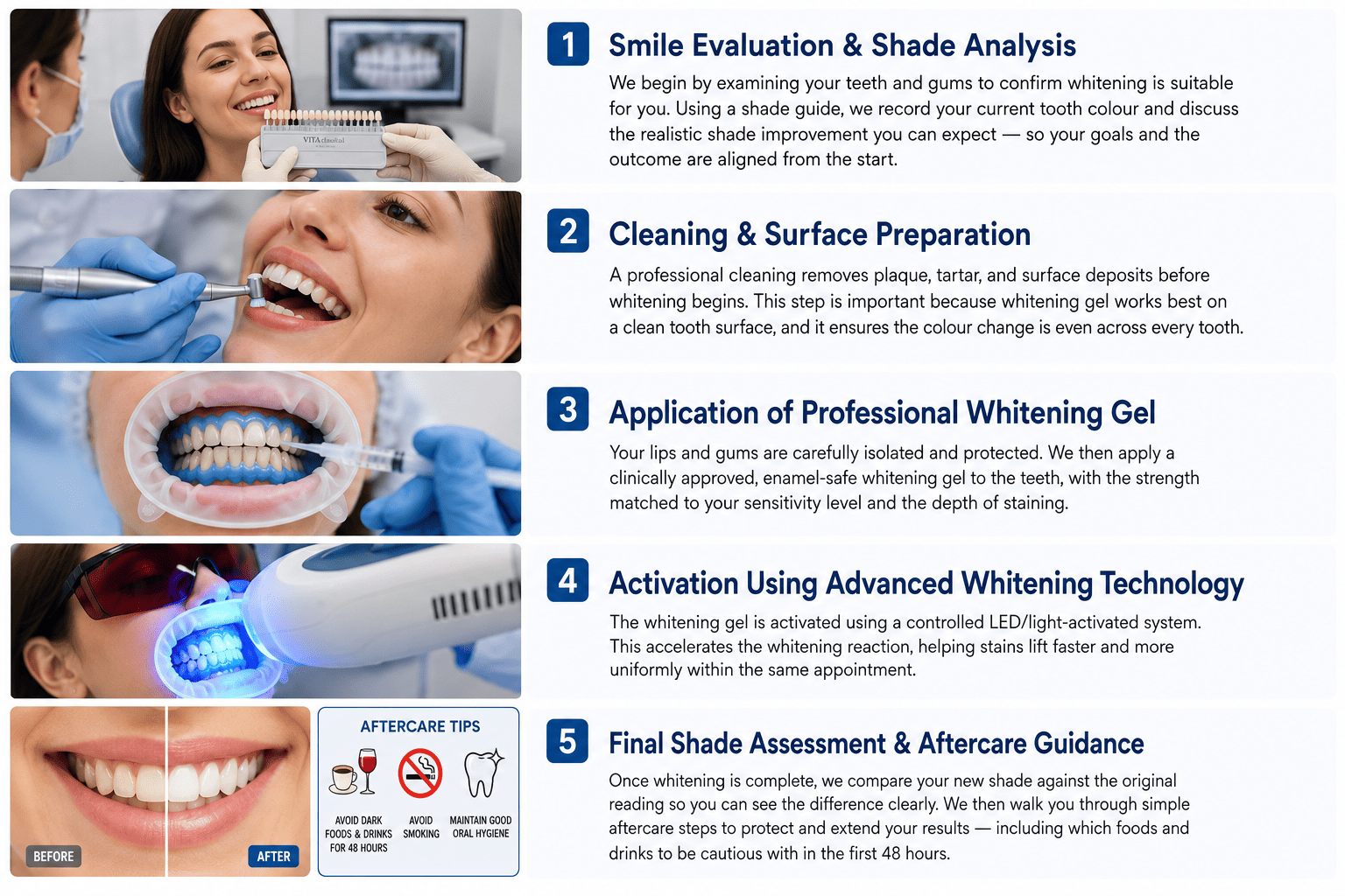 Teeth Whitening Process Step by Step True White Dental