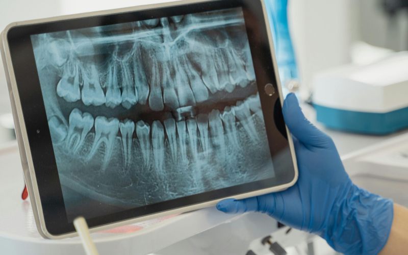 True White Dental Comprehensive Diagnosis
