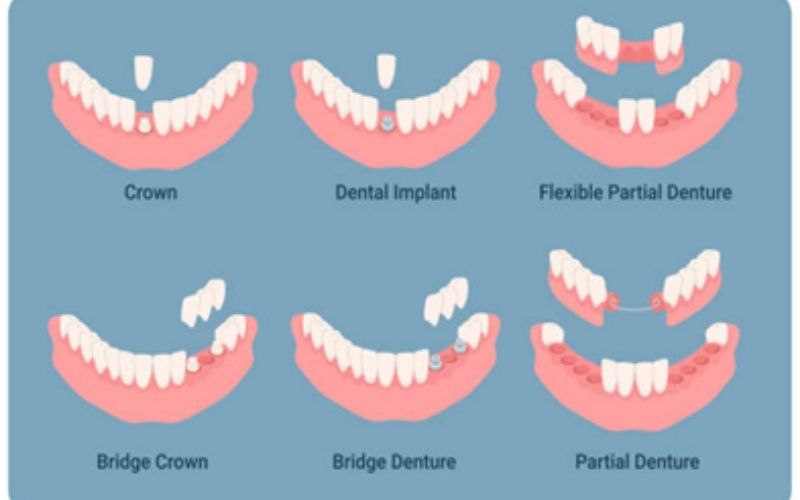 TrueWhiteDentalDentures truewhite True White Dental Dentures