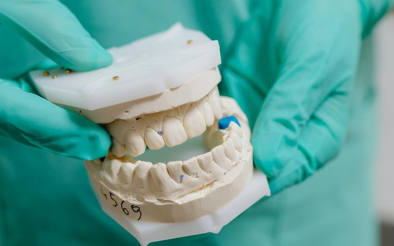 True White Dental Filling  Sealing the Tooth