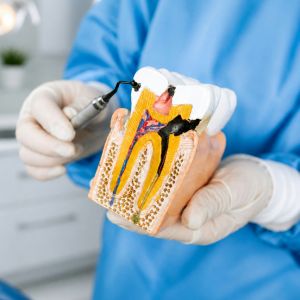 True White Dental Root Canal Treatment
