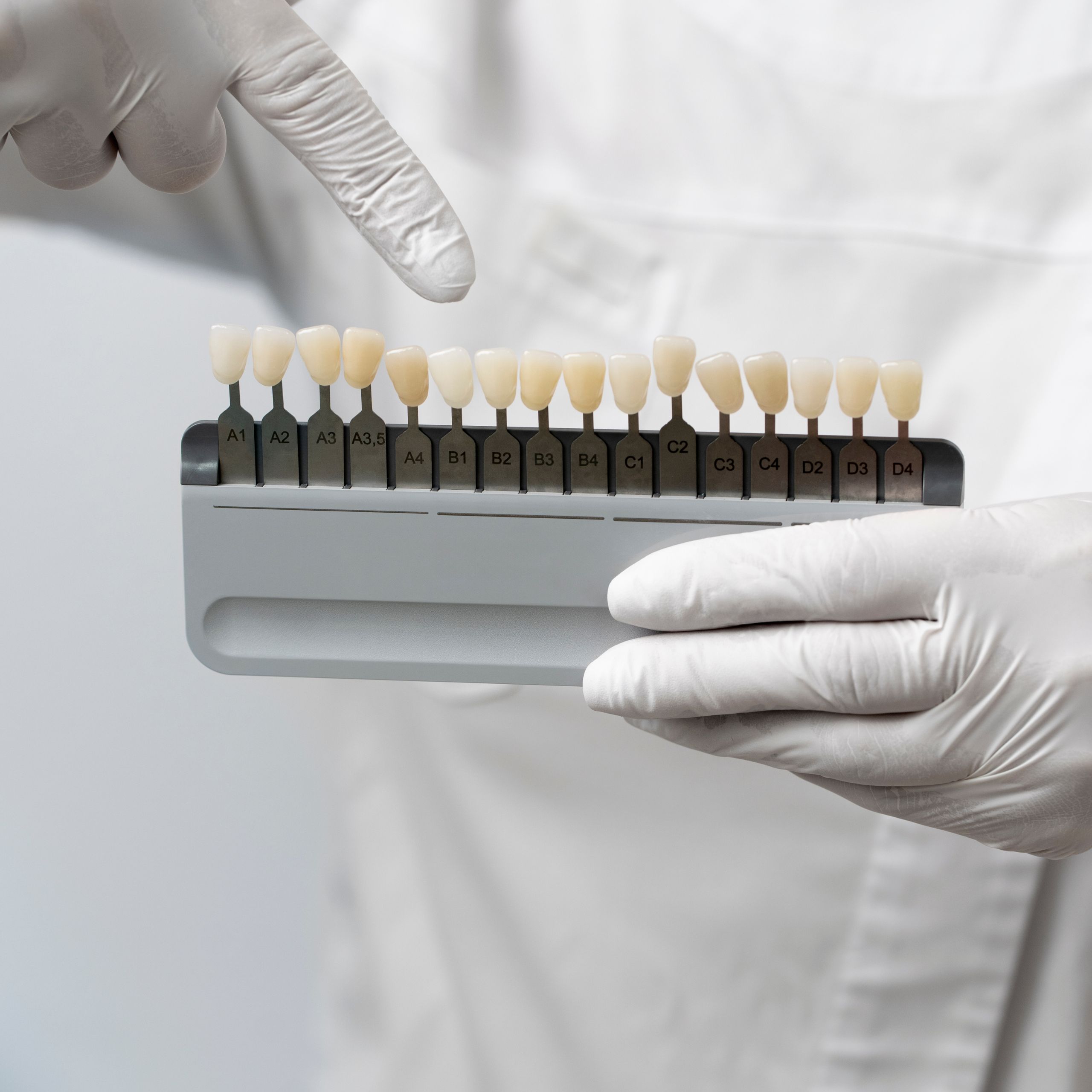 True White Dental Traditional Porcelain Veneers