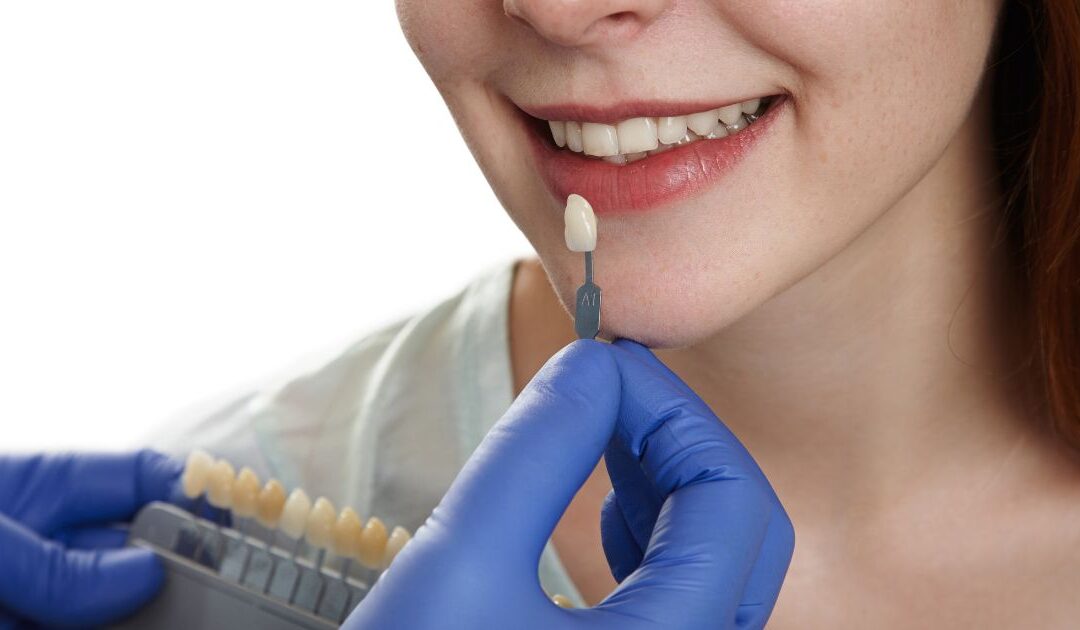 Ultra-Thin Veneers vs Traditional Veneers: Which One Suits Indian Teeth Better