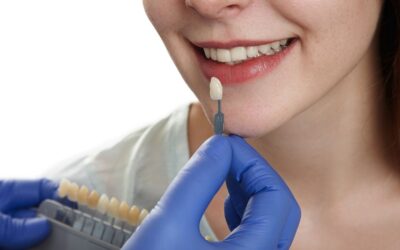Ultra-Thin Veneers vs Traditional Veneers: Which One Suits Indian Teeth Better