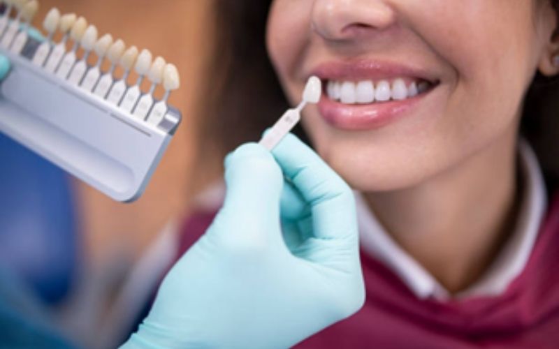 TrueWhiteDentalVeneers truewhite True White Dental Veneers
