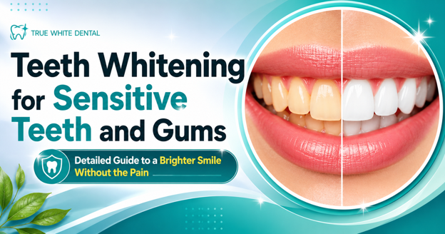 Teeth Whitening for Sensitive Teeth and Gums – A Detailed Guide to a Brighter Smile Without the Pain