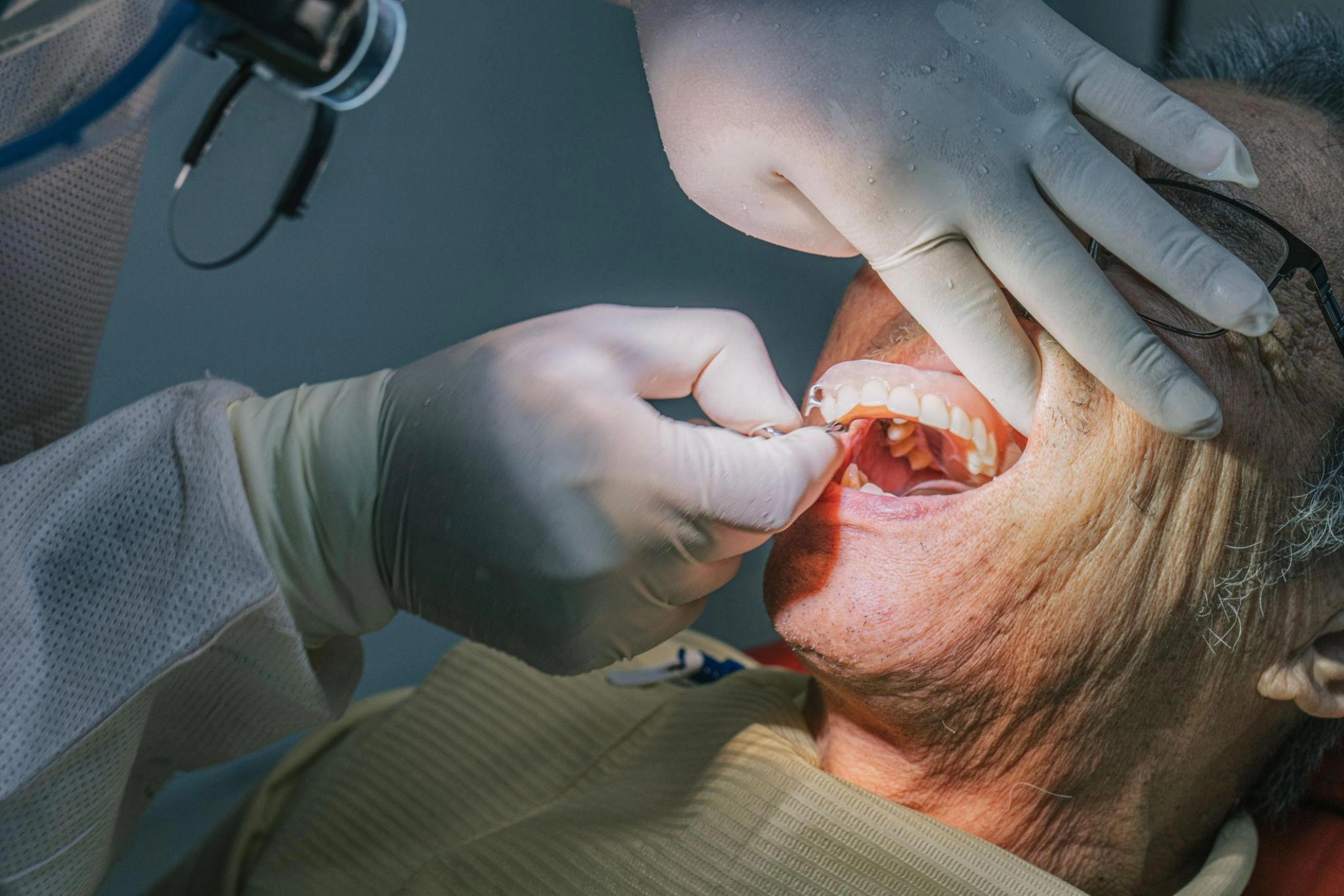 FinalDenturePlacement truewhite Dentist in gloves performing a dental procedure on an elderly patient view of mouth and teeth
