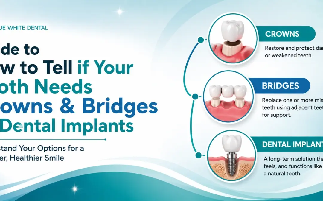 Guide to How to Tell if Your Tooth Needs Crowns & Bridges or Dental Implants