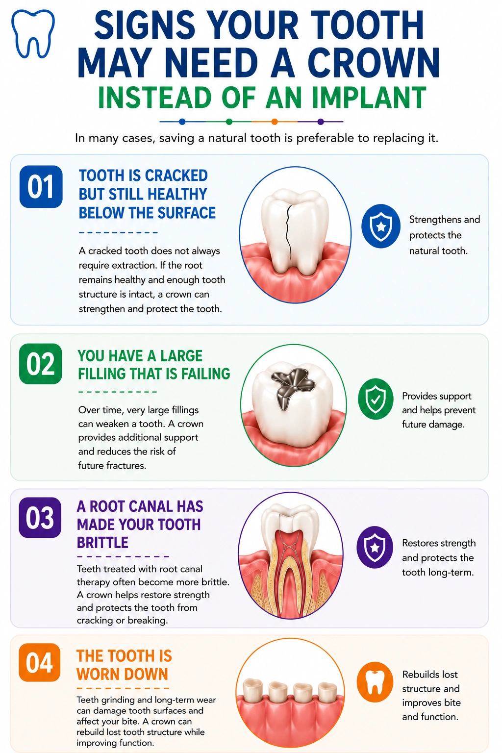 Infographic about when a tooth may need a crown instead of an implant with four illustrated scenarios and brief explanations