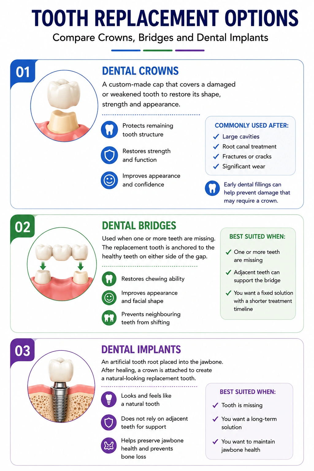 Infographic comparing dental crowns bridges and implants with icons and bullet points for each option