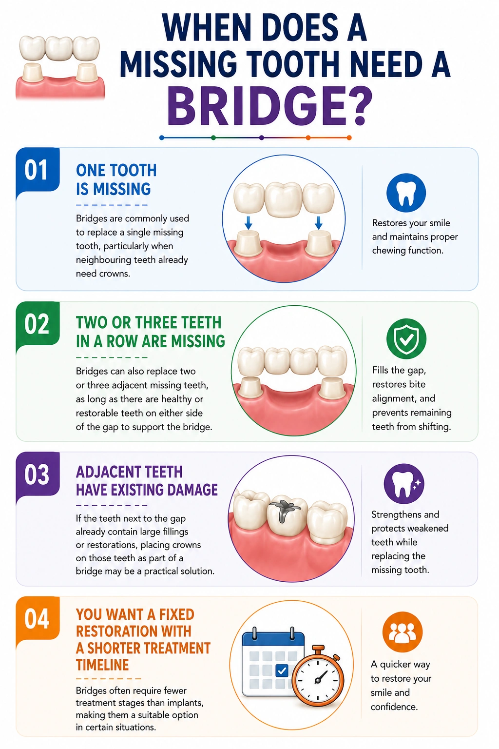 Infographic explaining when a missing tooth needs a dental bridge and its four steps with illustrations of teeth and a bridge