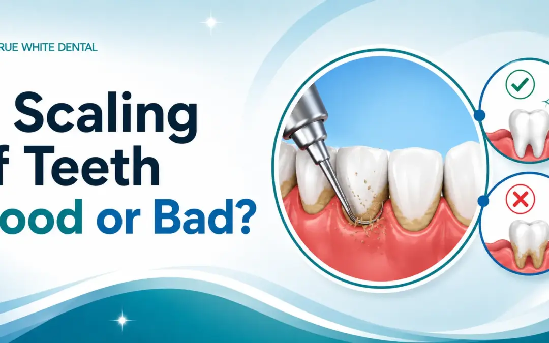 Is Scaling of Teeth Good or Bad?